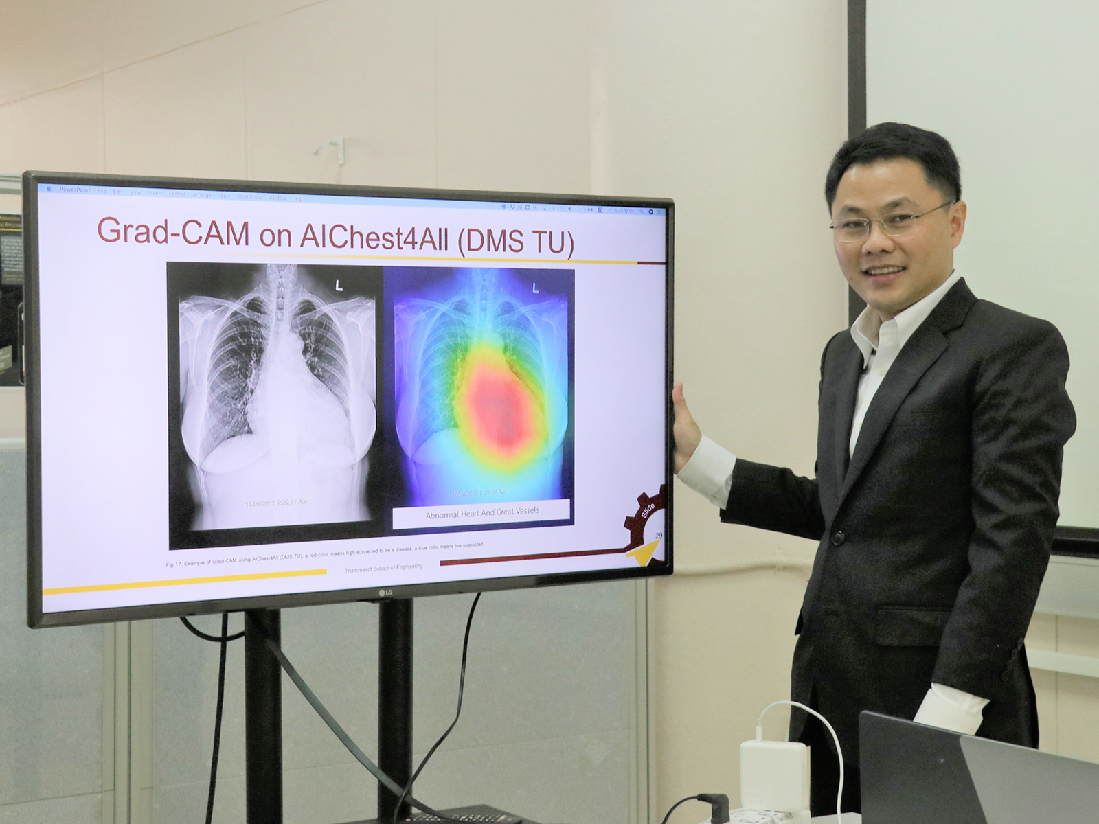 A researcher at Thammasat University demonstrates the AI Chest 4 All system