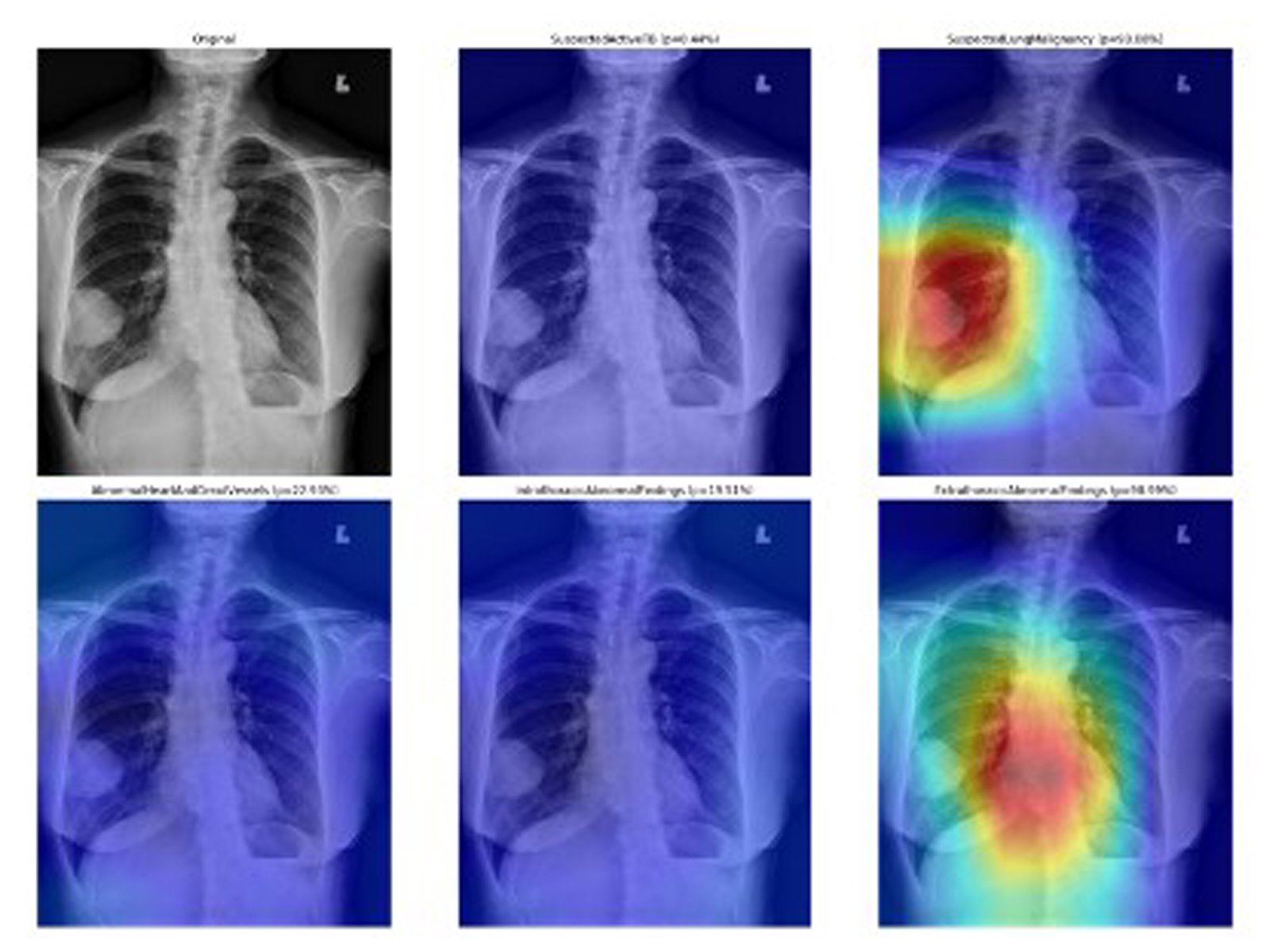 X-rays on the AI Chest 4 All system